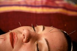 GET THE POINT? :  Acupuncture is one of several treatments available at the new Savvi Skin and Body Studio. - PHOTO BY JESSE ACOSTA