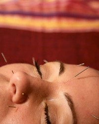 GET THE POINT? :  Acupuncture is one of several treatments available at the new Savvi Skin and Body Studio.